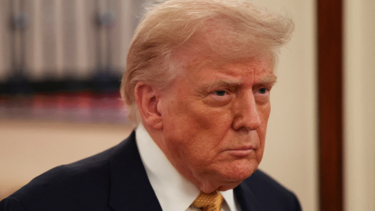 Trump diagnosed chronic venous insufficiency
