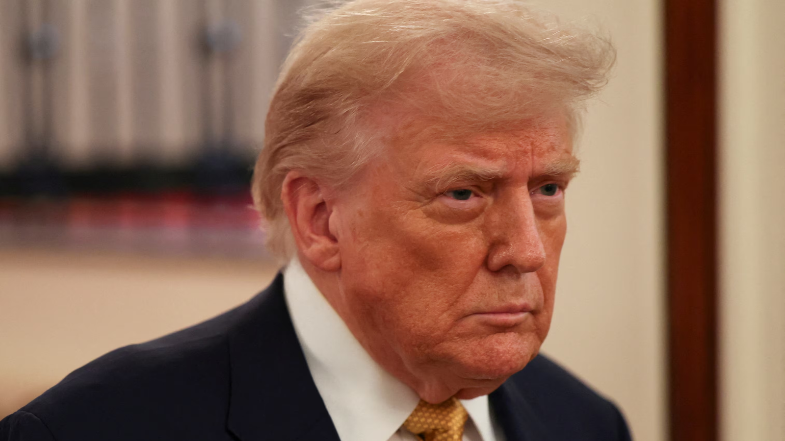 Trump diagnosed chronic venous insufficiency